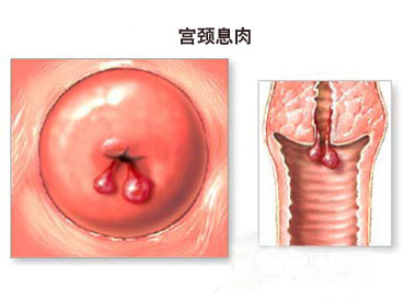 孕期遭遇出血 三大案例分析